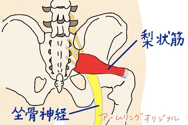 梨状筋をほぐすメリット